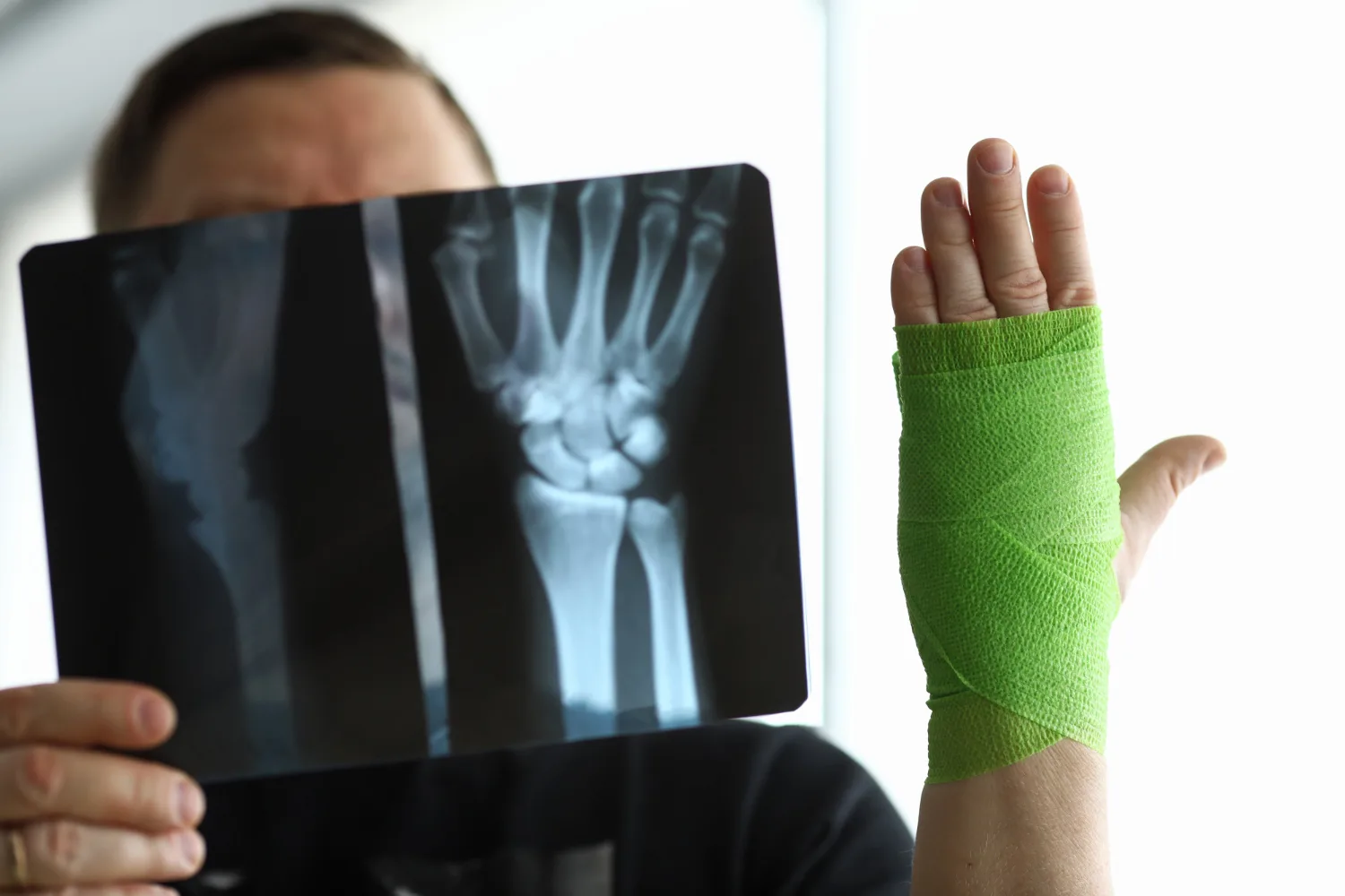 Valoración y atención de fracturas